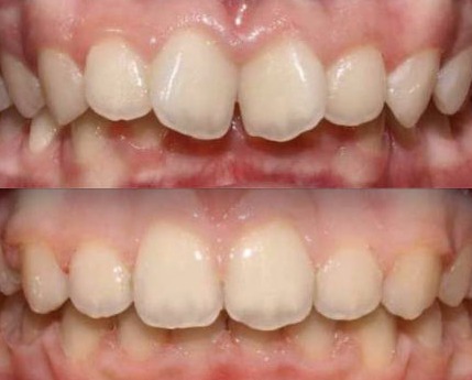 Brekety-Lviv-DentalKnysh-photo-1