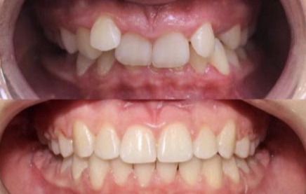 Brekety Lviv Dentalknysh photo 2